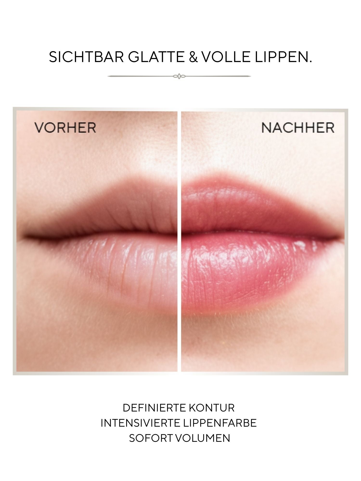 Firming Lip Volumizer MD CREYAN