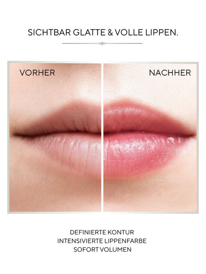 Firming Lip Volumizer MD CREYAN